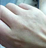 的脸第十期：秋冬护手困扰CQ9电子平台网站救救我(图2)